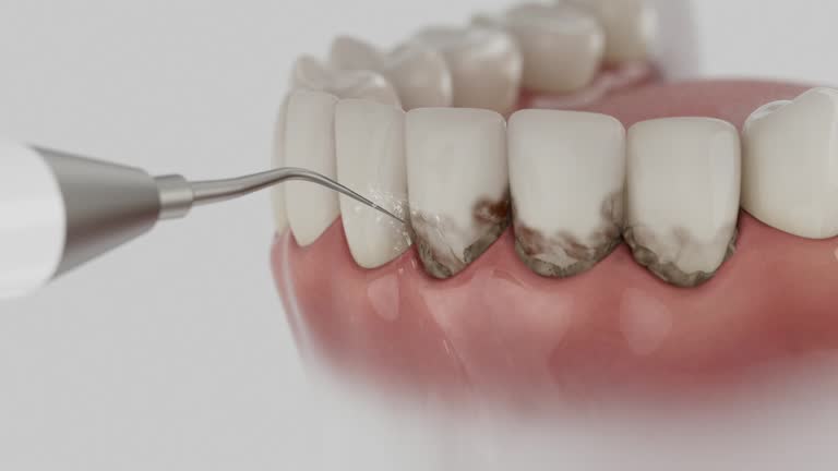Trusted Dental Crowns And Bridges service in Deer Park, OH - Dentist Open Now